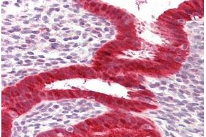 Anti-RIG-1 / RIG-I antibody IHC staining of human uterus. (DDX58 anticorps  (AA 200-250))