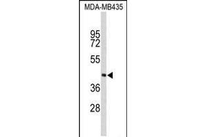 Western blot analysis of PHYH Antibody in MDA-MB435 cell line lysates (35ug/lane)