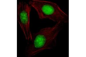 Immunofluorescence (IF) image for anti-Sterol Regulatory Element Binding Transcription Factor 2 (SREBF2) antibody (ABIN2995769)