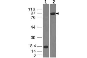 Image no. 1 for anti-Cadherin 1, Type 1, E-Cadherin (Epithelial) (CDH1) (AA 438-556) antibody (ABIN5027174)