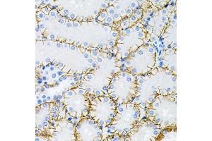 Immunohistochemistry of paraffin-embedded mouse kidney using Tau antibody (ABIN3021441, ABIN3021442, ABIN3021443 and ABIN6215045) at dilution of 1:100 (40x lens). (MAPT anticorps  (AA 1-100))