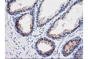 Immunohistochemical staining of paraffin-embedded Human prostate tissue using anti-SEC14L2 mouse monoclonal antibody. (SEC14L2 anticorps)