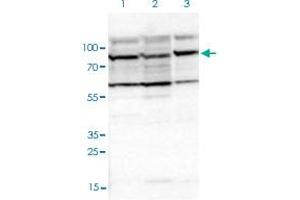 Western blot analysis of Lane 1: Human cell line RT-4; Lane 2: Human cell line U-251MG sp; Lane 3: Human plasma (IgG/HSA depleted) with EIF4ENIF1 polyclonal antibody  at 1:100-1:250 dilution. (EIF4ENIF1 anticorps)