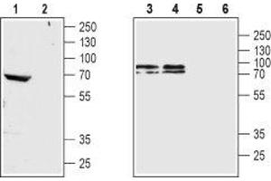 Western blot analysis of rat brain membrane (lanes 1 and 2), mouse brain membrane (lane 3 and 5) and SH-SY5Y cell lysate (lanes 4 and 6): - 1,3,4. (CHRM4 anticorps  (3rd Intracellular Loop))