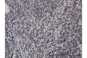 Immunoperoxidase of monoclonal antibody to IKBKE on formalin-fixed paraffin-embedded human tonsil.