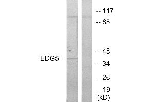 Western blot analysis of extracts from COLO205 cells, using EDG5 antibody.