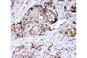 IHC analysis of RPSA using anti-RPSA antibody (ABIN4886715). (RPSA/Laminin Receptor anticorps  (AA 2-138))