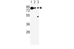Western Blotting (WB) image for anti-Dopachrome Tautomerase (DCT) antibody (ABIN5024316) (DCT anticorps)
