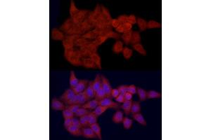 Immunofluorescence analysis of HeLa cells using SLC27 Rabbit pAb (2847) at dilution of 1:100 (40x lens). (SLC27A1 anticorps  (AA 347-646))