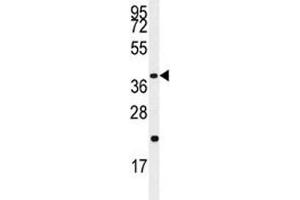 Western blot analysis of Caspase-9 antibody and Jurkat lysate (Caspase 9 anticorps  (Ser196))