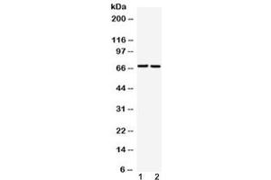 Western blot testing of 1) rat liver and 2) human A549 cell lysate with GAA antibody at 0. (GAA anticorps  (AA 494-527))