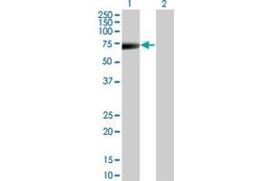 Western Blot analysis of KRT5 expression in transfected 293T cell line by KRT5 monoclonal antibody (M08), clone 1A12. (Cytokeratin 5 anticorps  (AA 1-590))