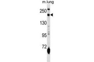 Western blot analysis in mouse lung tissue lysates (35ug/lane) using CD206 / MRC1 Antibody (N-term). (Macrophage Mannose Receptor 1 anticorps  (N-Term))