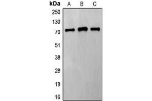 Western blot analysis of Frizzled 8 expression in HeLa (A), Jurkat (B), MCF7 (C) whole cell lysates. (FZD8 anticorps  (C-Term))