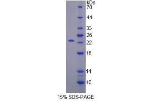 SDS-PAGE analysis of Human SCEL Protein.
