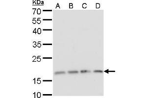 WB Image RPS15 antibody detects RPS15 protein by Western blot analysis. (RPS15 anticorps)
