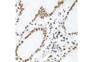 Immunohistochemistry of paraffin-embedded human stomach using KHDRBS1 antibody.