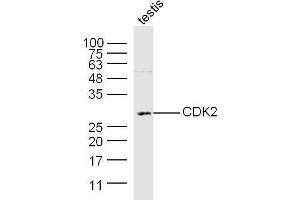 Mouse testis lysates probed with CDK2 Polyclonal Antibody, Unconjugated  at 1:300 dilution and 4˚C overnight incubation. (CDK2 anticorps  (AA 201-298))