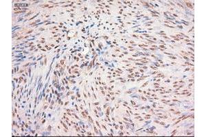 Image no. 1 for anti-Myc Proto-Oncogene protein (MYC) antibody (ABIN1497013) (c-MYC anticorps)