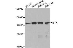Western blot analysis of extracts of various cell lines, using BTK antibody. (BTK anticorps  (AA 173-272))