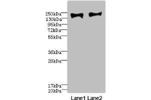 Western blot All lanes: MRC2 antibody at 3. (MRC2 anticorps  (AA 120-300))