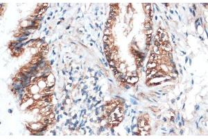 Immunohistochemistry of paraffin-embedded Rat lung using Aquaporin 4 Polyclonal Antibody at dilution of 1:100 (40x lens).