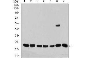 Western blot analysis using VIMP mouse mAb against MCF-7 (1), PANC-1 (2), Jurkat (3), HepG2 (4), MOLT4 (5), U251 (6), and A431 (7) cell lysate.