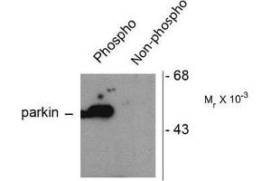 Image no. 1 for anti-Parkinson Protein 2, E3 Ubiquitin Protein Ligase (Parkin) (PARK2) (pSer101) antibody (ABIN372697) (Parkin anticorps  (pSer101))