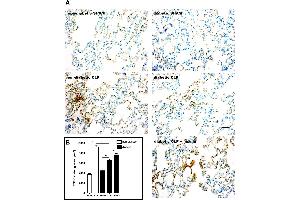 Expression of TGF-β in the lung parenchyma after CLP.