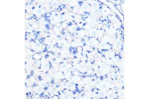 Immunohistochemistry of paraffin-embedded rat ovary using Na+/K+-ATPase Rabbit mAb (ABIN7270390) at dilution of 1:100 (40x lens). (ATP1A1 anticorps)