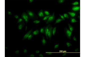 Immunofluorescence of monoclonal antibody to CLK3 on HeLa cell.