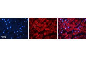 Rabbit Anti-EIF3E Antibody   Formalin Fixed Paraffin Embedded Tissue: Human heart Tissue Observed Staining: Cytoplasmic, nucleus Primary Antibody Concentration: 1:100 Other Working Concentrations: N/A Secondary Antibody: Donkey anti-Rabbit-Cy3 Secondary Antibody Concentration: 1:200 Magnification: 20X Exposure Time: 0.