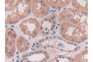 Detection of PCSK5 in Human Kidney Tissue using Polyclonal Antibody to Proprotein Convertase Subtilisin/Kexin Type 5 (PCSK5)