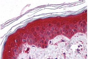 Human Skin (formalin-fixed, paraffin-embedded) stained with PYCARD antibody ABIN213971 at 5 ug/ml followed by biotinylated goat anti-rabbit IgG secondary antibody ABIN481713, alkaline phosphatase-streptavidin and chromogen. (PYCARD anticorps  (AA 182-195))