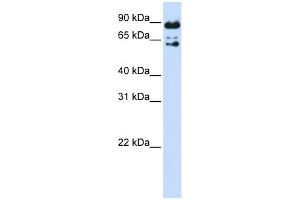 WB Suggested Anti-PPWD1 Antibody Titration: 0. (PPWD1 anticorps  (Middle Region))