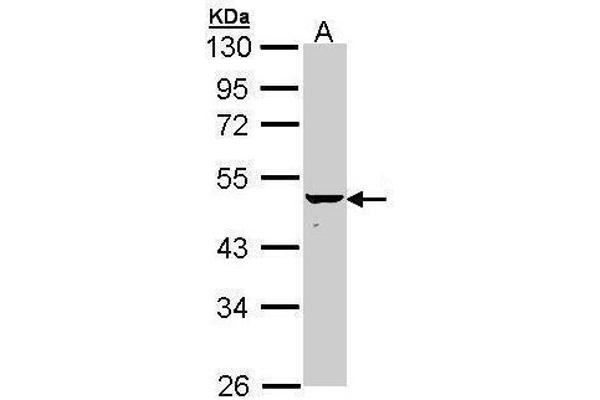 Keratin 34 anticorps