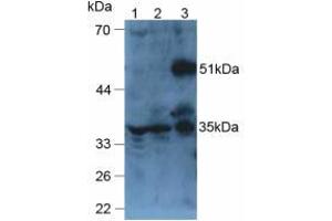 Figure. (ANGPTL6 anticorps  (AA 238-457))
