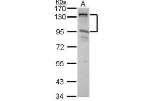 WB Image CIZ1 antibody [N2C1], Internal detects CIZ1 protein by Western blot analysis. (CIZ1 anticorps)