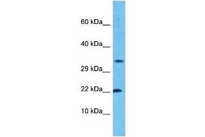 Host:  Rabbit  Target Name:  CROC4  Sample Type:  ACHN Whole Cell lysates  Antibody Dilution:  1. (C1orf61 anticorps  (N-Term))