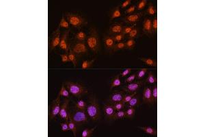Immunofluorescence analysis of C6 cells using // antibody (ABIN7265520) at dilution of 1:100. (AKT 1/2/3 anticorps)