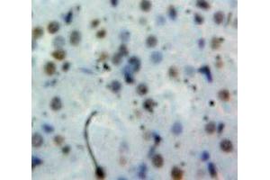 Used in DAB staining on fromalin fixed paraffin-embedded Kidney tissue