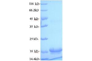 SDS-PAGE (SDS) image for Interleukin 10 (IL10) (AA 19-178) protein (His tag) (ABIN5713542)