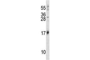 ISG15 antibody western blot analysis in 293 lysate (ISG15 anticorps  (AA 31-61))