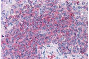 anti-5-Aminoimidazole-4-Carboxamide Ribonucleotide Formyltransferase/IMP Cyclohydrolase (ATIC) antibody