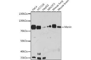 Western blot analysis of extracts of various cell lines, using Menin Rabbit mAb (ABIN7268697) at 1:1000 dilution. (Menin anticorps)