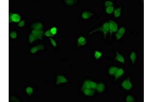 Immunofluorescent analysis of MCF-7 cells using ABIN7146085 at dilution of 1: 100 and Alexa Fluor 488-congugated AffiniPure Goat Anti-Rabbit IgG(H+L)