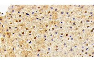 Detection of FGF2 in Rabbit Liver Tissue using Polyclonal Antibody to Fibroblast Growth Factor 2, Basic (FGF2) (FGF2 anticorps  (AA 26-153) (APC))