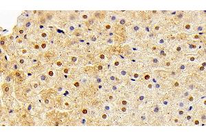 Detection of FGF2 in Rabbit Liver Tissue using Polyclonal Antibody to Fibroblast Growth Factor 2, Basic (FGF2) (FGF2 anticorps  (AA 26-153))