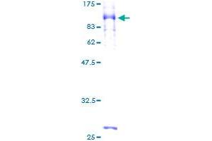 Image no. 1 for Suppressor of Cytokine Signaling 6 (SOCS6) (AA 1-535) protein (GST tag) (ABIN1320937)