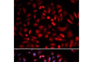 Immunofluorescence analysis of U2OS cells using PRKACB Polyclonal Antibody
